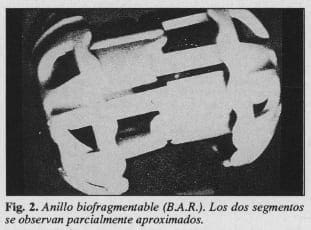 Anillo biofragmentable (BAR)