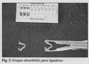 Grapas absorbibles para ligaduras