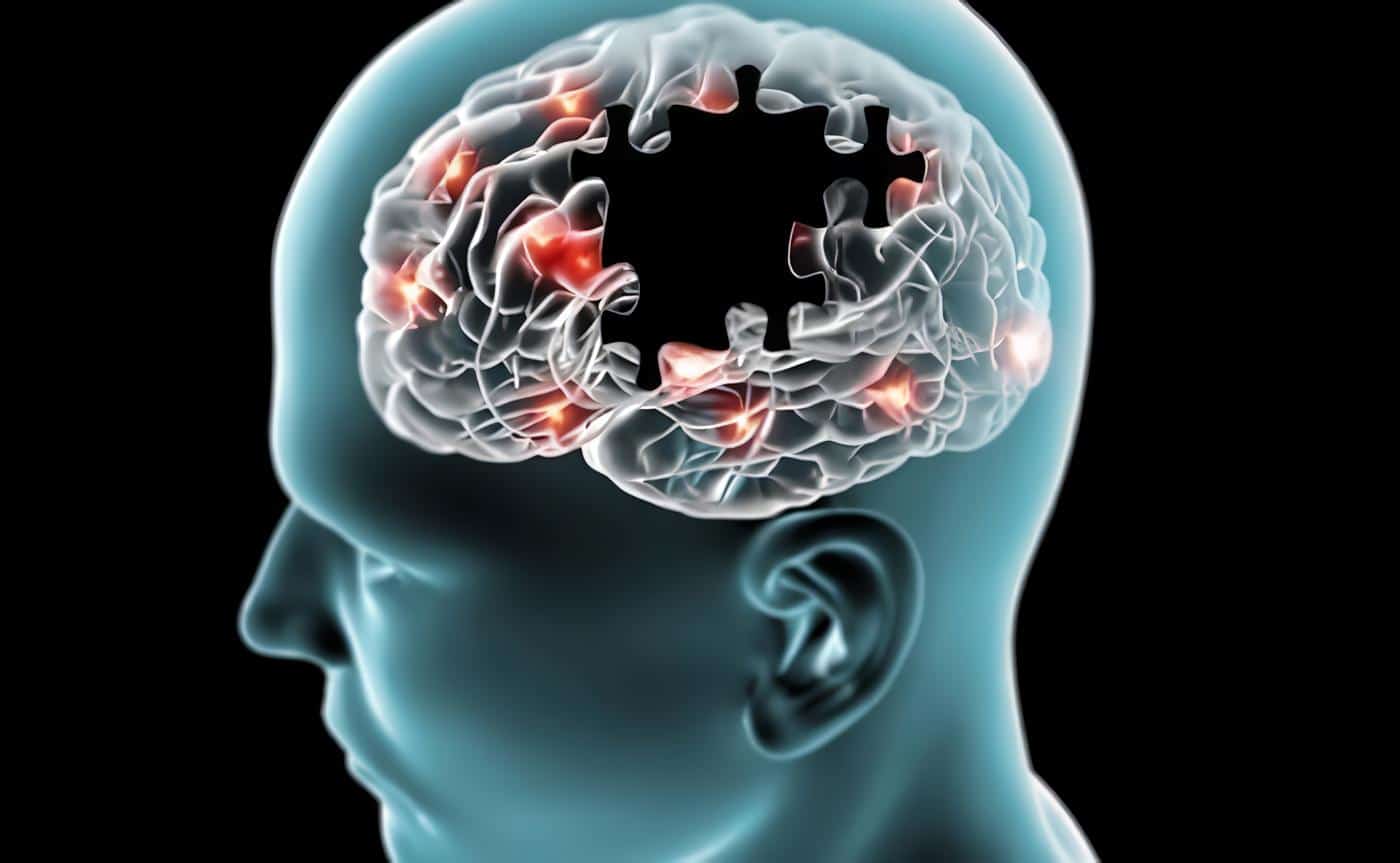 Neurobiología de la Conciencia