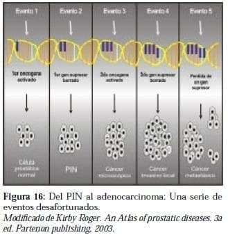 PIN al Adenocarcinoma: Una serie de eventos desafortunados