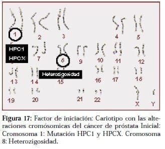 Cáncer de Próstata Inicial