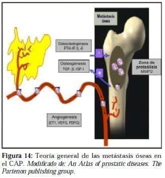 Teoría general de las Metástasis Óseas en el CAP Teoría general de las Metástasis Óseas en el CAP