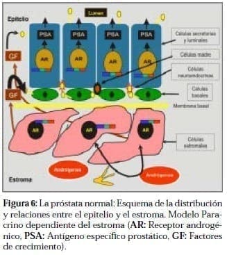 Próstata Normal: Esquema entre Epitelio y Estroma Próstata Normal: Esquema entre Epitelio y Estroma