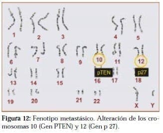 Fenotipo Metastásico Fenotipo Metastásico