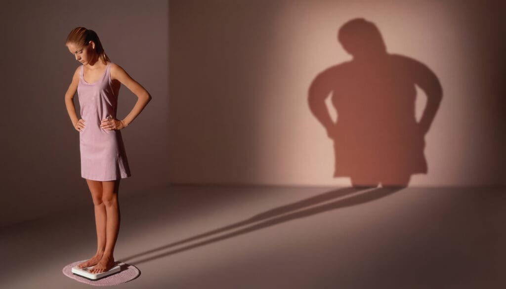 Anorexia y Bulimia