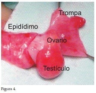 Conducto de Wolf como Epidídimo Conducto de Wolf como Epidídimo