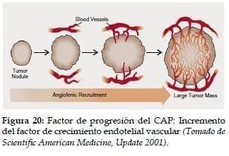 Incremento del factor de crecimiento Endotelial vascular
