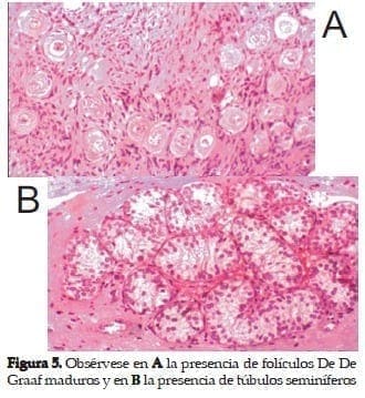 Folículos DeGraaf maduros y Túbulos Seminíferos  Folículos DeGraaf maduros y Túbulos Seminíferos