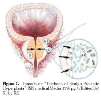 Hiperplasia Prostática Benigna