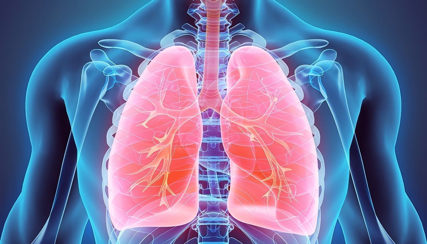 Tromboembolia Pulmonar, Guía de Salud