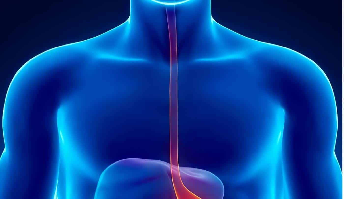 Acalasia Esofágica