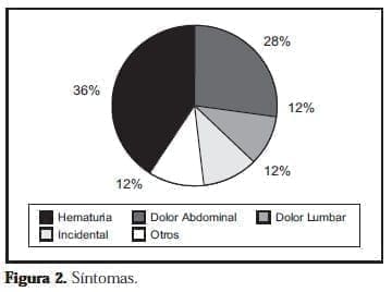 Masa Renal Síntomas Masa Renal Síntomas