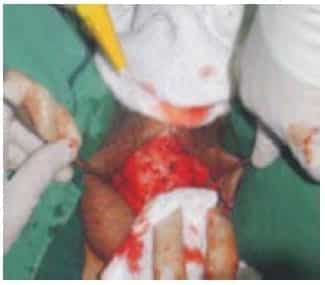 Presencia de un lápiz Presencia de un lápiz