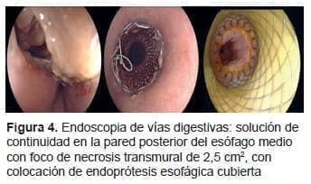 Endoscopia de Vías Digestivas Endoscopia de Vías Digestivas