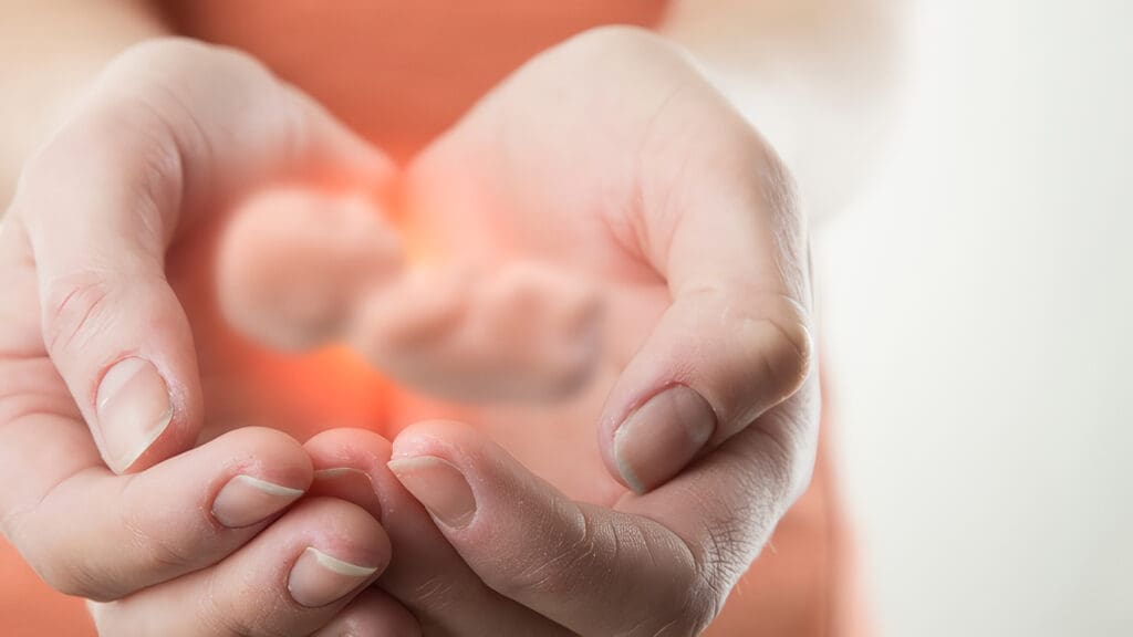 Aborto