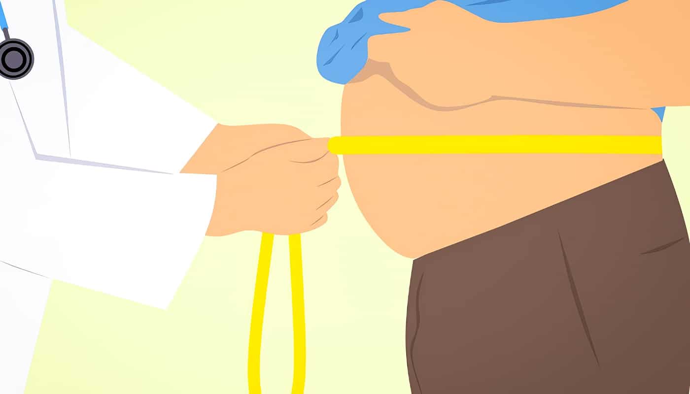 Tipos de Obesidad y sus Características