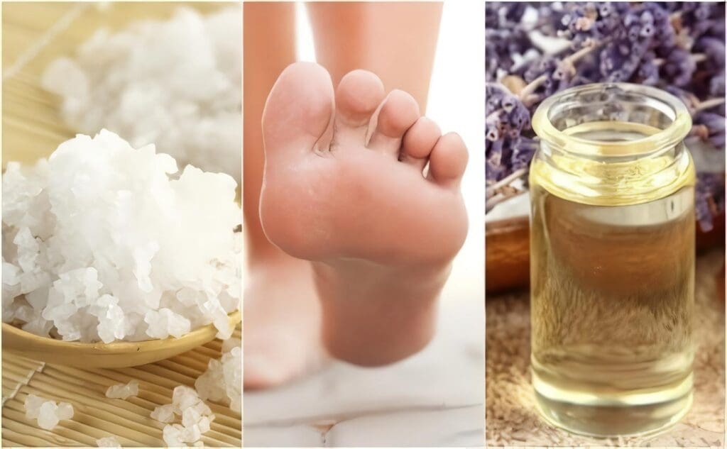 Remedios Caseros para la Fascitis Plantar