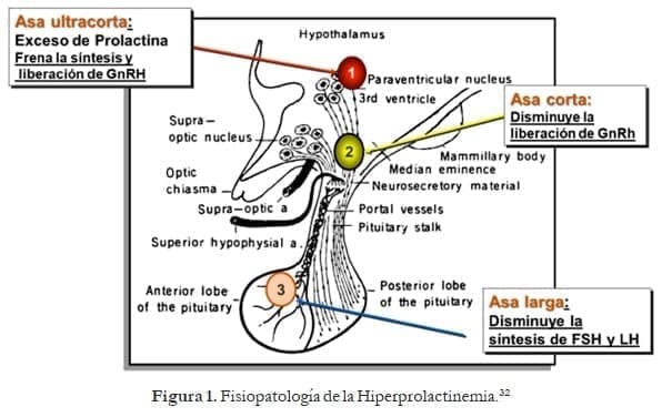 Fisiopatología de la Hiperprolactinemia Fisiopatología de la Hiperprolactinemia