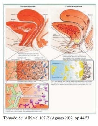 Flora Vaginal Flora Vaginal