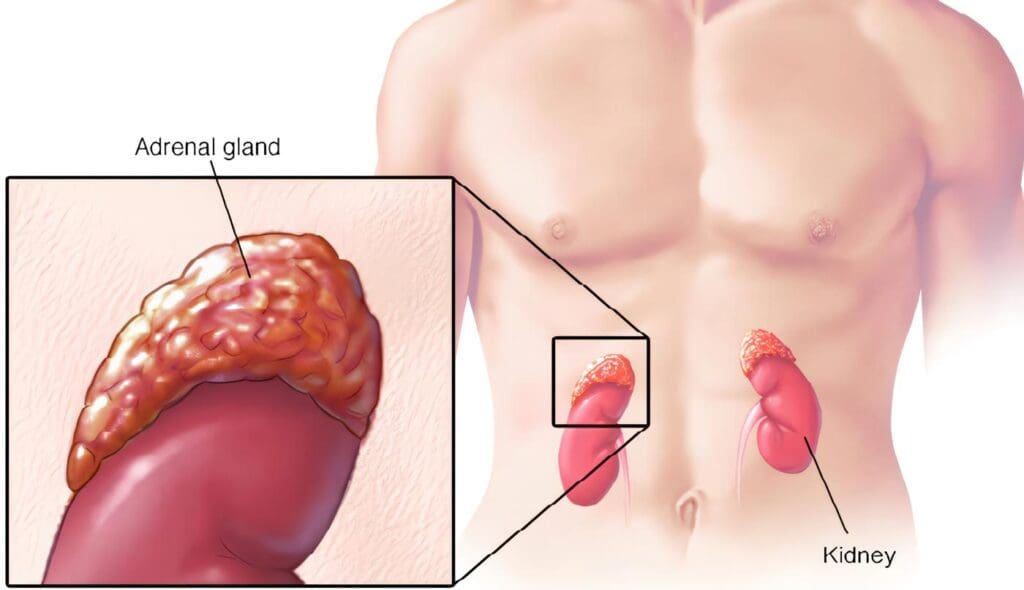 Glándula Adrenal