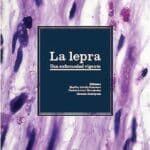La Lepra La Lepra
