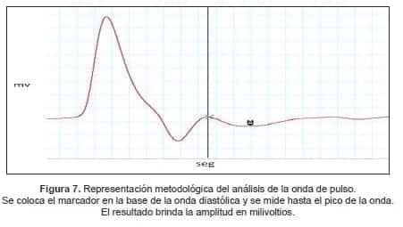 Se coloca el marcador en la base de la onda diastólica y se mide hasta el pico de la onda Se coloca el marcador en la base de la onda diastólica y se mide hasta el pico de la onda