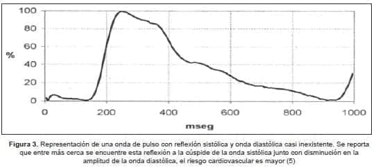 Representación de una onda de pulso con reflexión sistólica y onda diastólica casi inexistente Representación de una onda de pulso con reflexión sistólica y onda diastólica casi inexistente