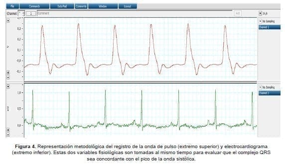 Representación metodológica del registro de la onda de pulso y electrocardiograma Representación metodológica del registro de la onda de pulso y electrocardiograma
