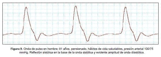 Onda de pulso en hombre: 81 años Onda de pulso en hombre: 81 años