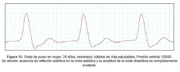 Onda de pulso en mujer: 28 años, secretaria Onda de pulso en mujer: 28 años, secretaria