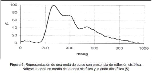 Representación de una onda de pulso con presencia de reflexión sistólica. Representación de una onda de pulso con presencia de reflexión sistólica