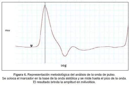 Se coloca el marcador en la base de la onda sistólica y se mide hasta el pico de la onda Se coloca el marcador en la base de la onda sistólica y se mide hasta el pico de la onda
