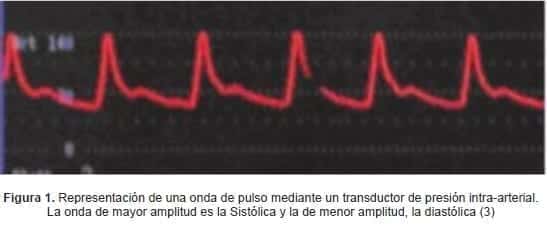 Representación de una onda de pulso mediante un transductor de presión intra-arterial. Representación de una onda de pulso mediante un transductor de presión intra-arterial.