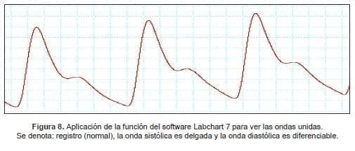 Aplicación de la función del software Labchart 7 para ver las ondas unidas Aplicación de la función del software Labchart 7 para ver las ondas unidas