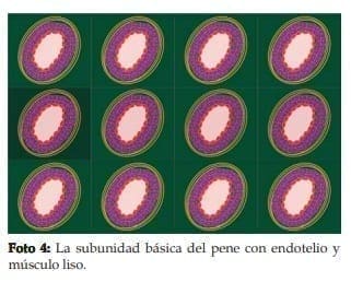 La subunidad básica del pene con endotelio y músculo liso.  La subunidad básica del pene con endotelio y músculo liso.