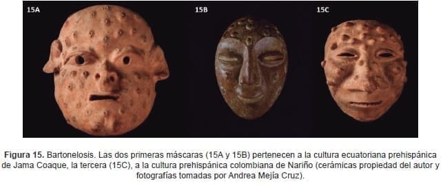 Bartonelosis. Las dos primeras máscaras Bartonelosis. Las dos primeras máscaras