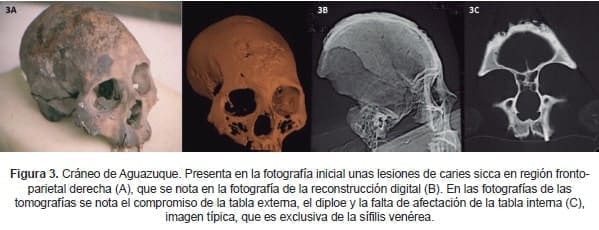 Cráneo de Aguazuque Cráneo de Aguazuque