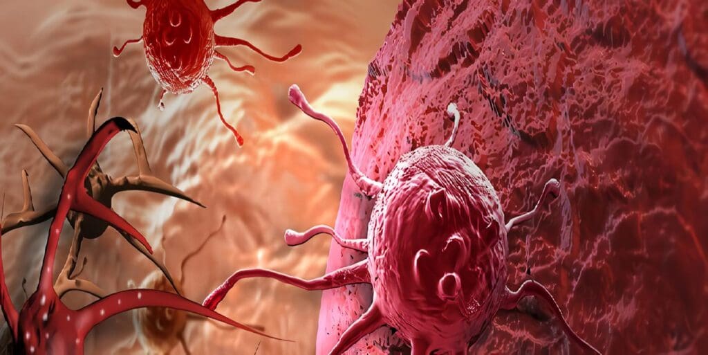 Neoplasias Malignas y Benignas