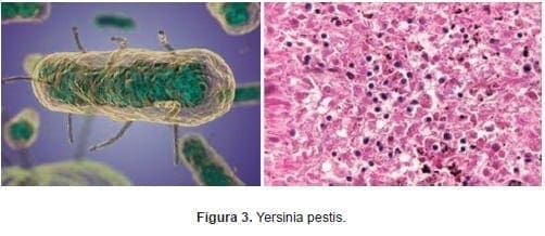 Yersinia pestis Yersinia pestis