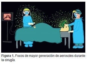 Focos de mayor generación de aerosoles durante la cirugía