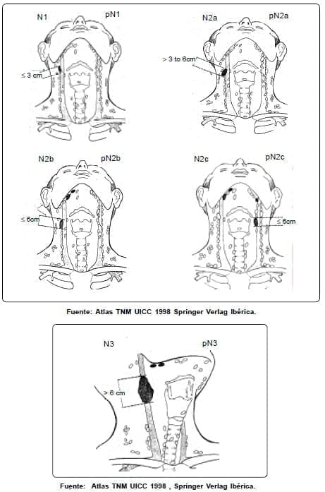 Carcinoma de Lengua - Ganglios linfáticos regionales (N)