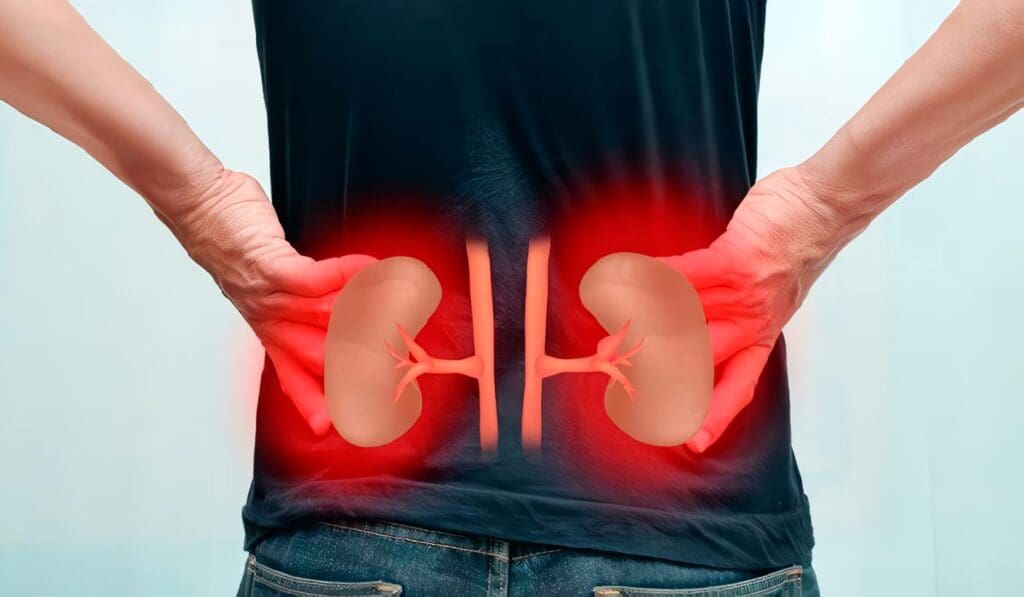 Enfermedad Renal Crónica Progresiva