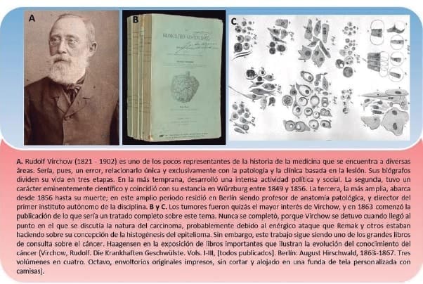 Rudolf Virchow, Tumores Malignos