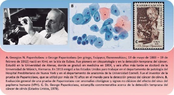 Georgios Papanikolaou - cáncer de vejiga