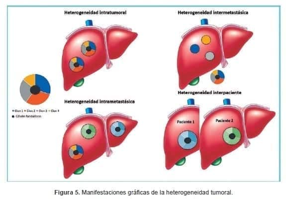 Manifestaciones gráficas de la heterogeneidad tumoral