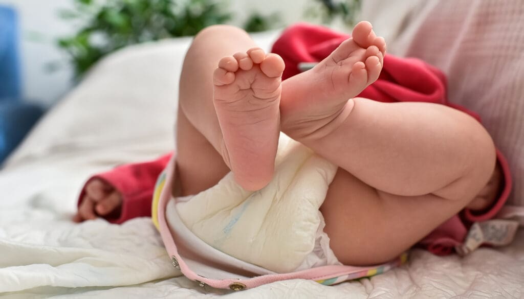 Balanitis en Bebés