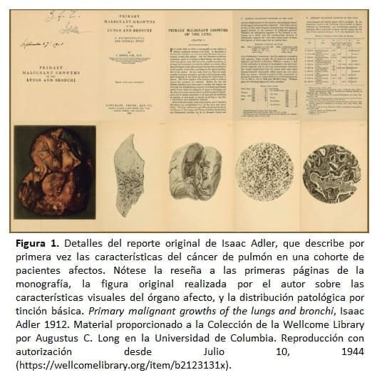 Cáncer de Pulmon, Detalles del reporte original de Isaac Adler Cáncer de Pulmon, Detalles del reporte original de Isaac Adler