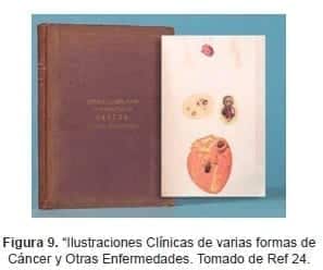 Ilustraciones Clínicas de varias formas de Cáncer y Otras Enfermedades Ilustraciones Clínicas de varias formas de Cáncer y Otras Enfermedades