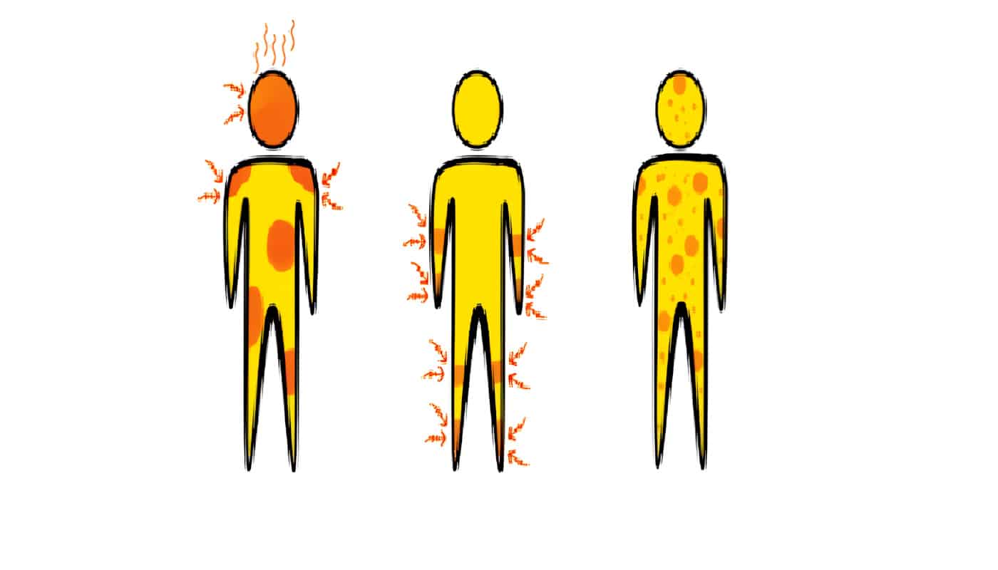 Guía de Atención del Dengue