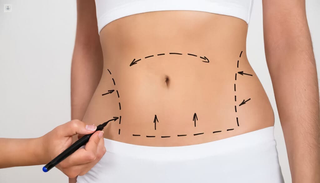 Beneficios de la Lipoescultura